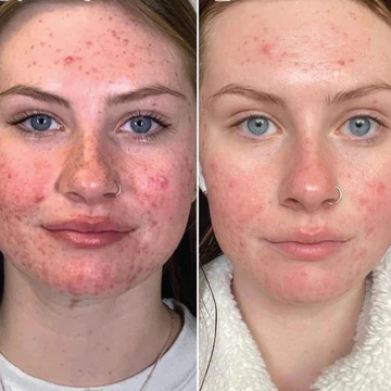 B_A_sforWebsite-V02-01_390x