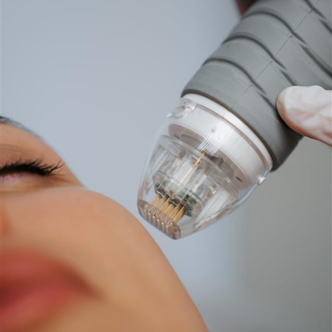 Untitled design (4) (1)