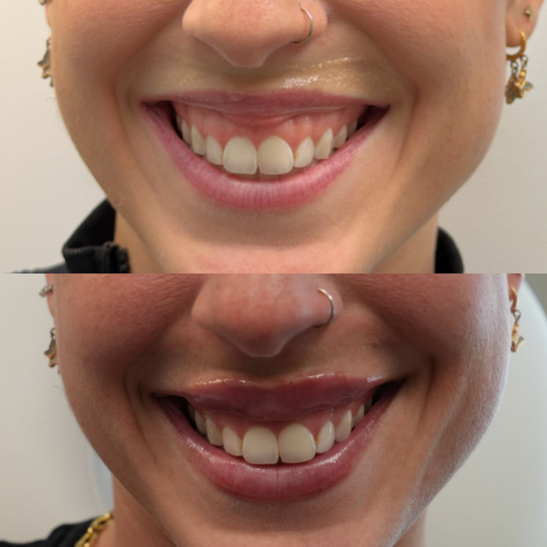 Website Content (23)